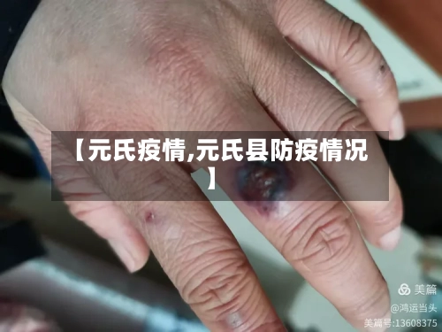 【元氏疫情,元氏县防疫情况】-第3张图片