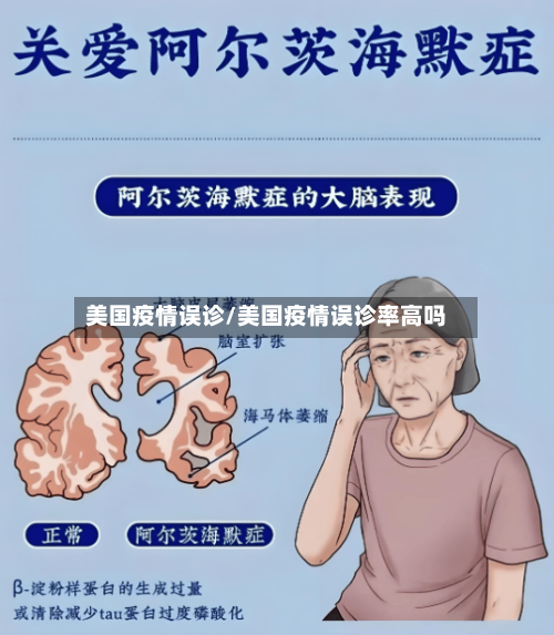 美国疫情误诊/美国疫情误诊率高吗-第3张图片