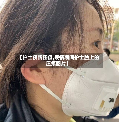 【护士疫情压痕,疫情期间护士脸上的压痕图片】