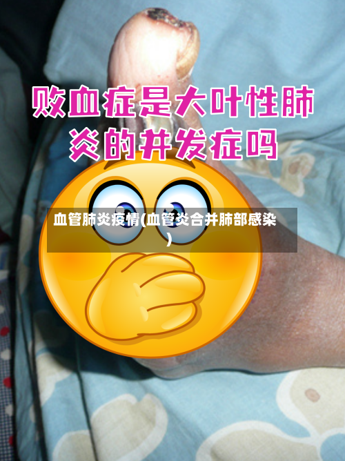 血管肺炎疫情(血管炎合并肺部感染)-第3张图片