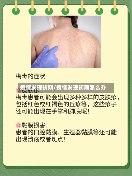 疫情发现初期/疫情发现初期怎么办-第2张图片