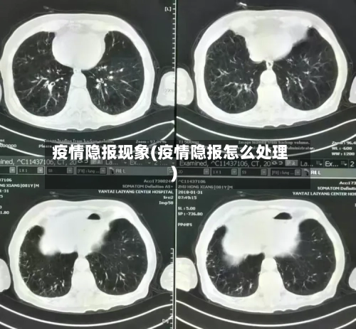 疫情隐报现象(疫情隐报怎么处理)-第2张图片
