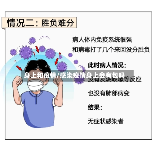 身上和疫情/感染疫情身上会有包吗-第3张图片