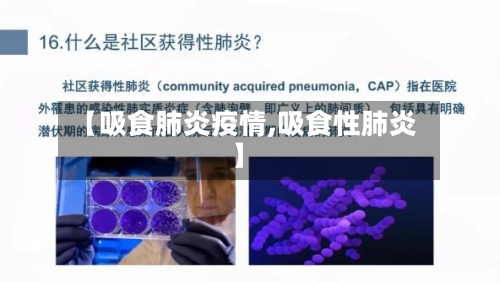 【吸食肺炎疫情,吸食性肺炎】-第2张图片