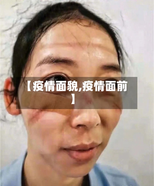 【疫情面貌,疫情面前】