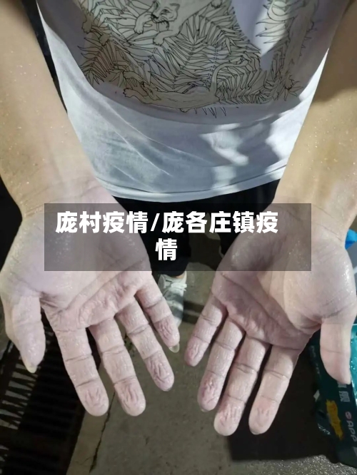庞村疫情/庞各庄镇疫情