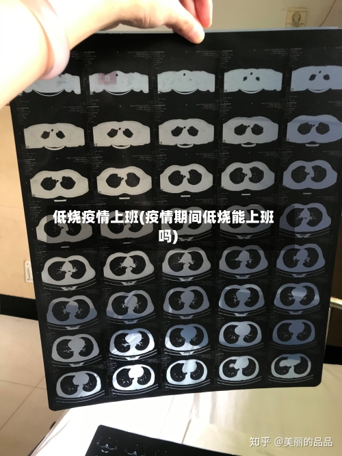 低烧疫情上班(疫情期间低烧能上班吗)-第2张图片