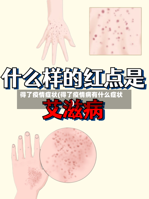 得了疫情症状(得了疫情病有什么症状)-第2张图片