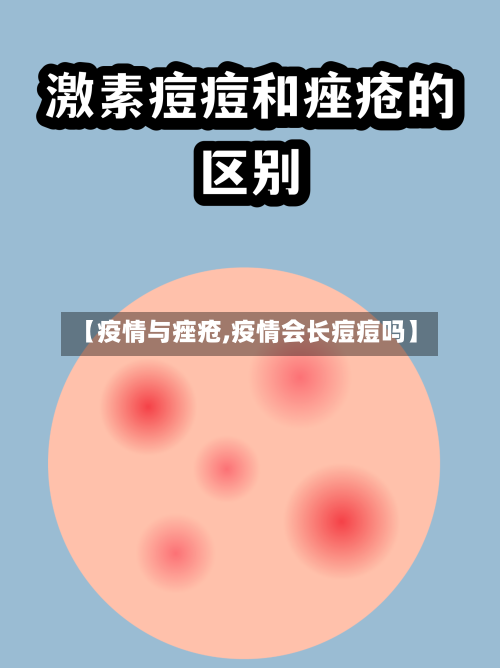 【疫情与痤疮,疫情会长痘痘吗】-第3张图片
