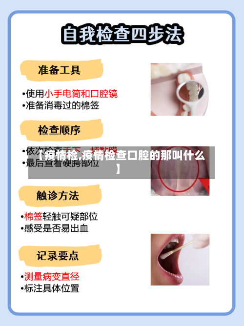 【疫情检,疫情检查口腔的那叫什么】