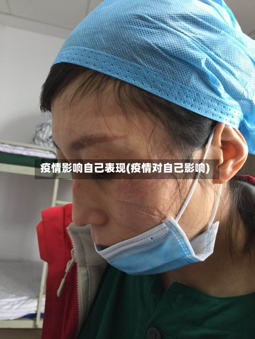 疫情影响自己表现(疫情对自己影响)-第3张图片