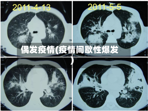 偶发疫情(疫情间歇性爆发)-第2张图片