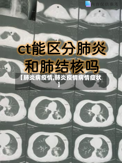 【肺炎病疫情,肺炎疫情病情症状】-第2张图片