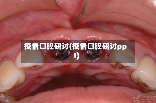 疫情口腔研讨(疫情口腔研讨ppt)-第2张图片