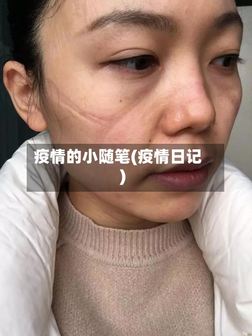 疫情的小随笔(疫情日记)