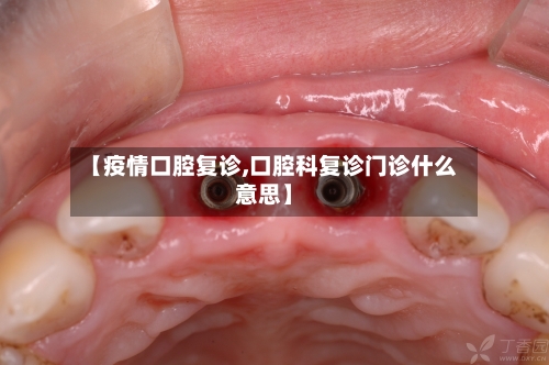 【疫情口腔复诊,口腔科复诊门诊什么意思】-第2张图片