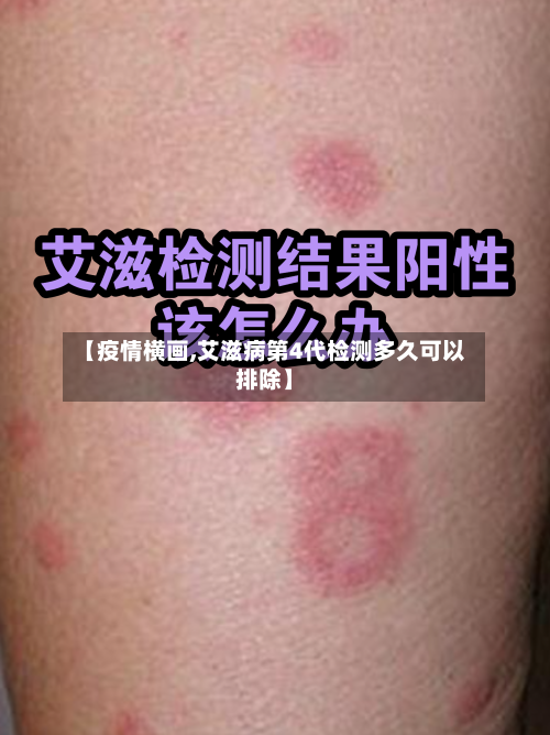 【疫情横画,艾滋病第4代检测多久可以排除】-第3张图片
