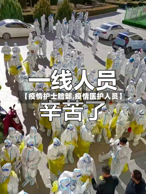 【疫情护士脸部,疫情医护人员】-第2张图片