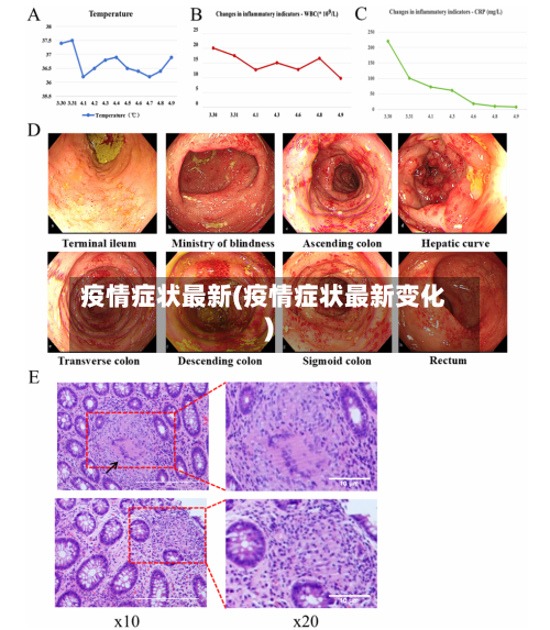 疫情症状最新(疫情症状最新变化)