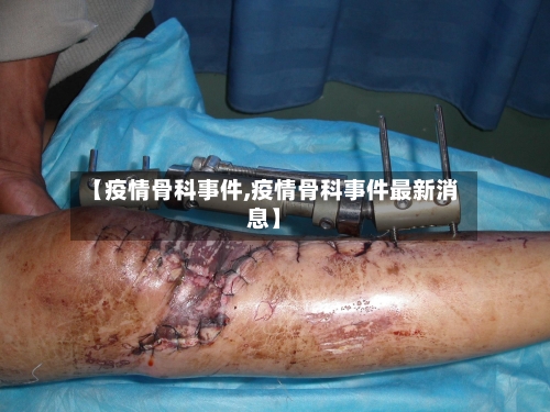 【疫情骨科事件,疫情骨科事件最新消息】-第2张图片
